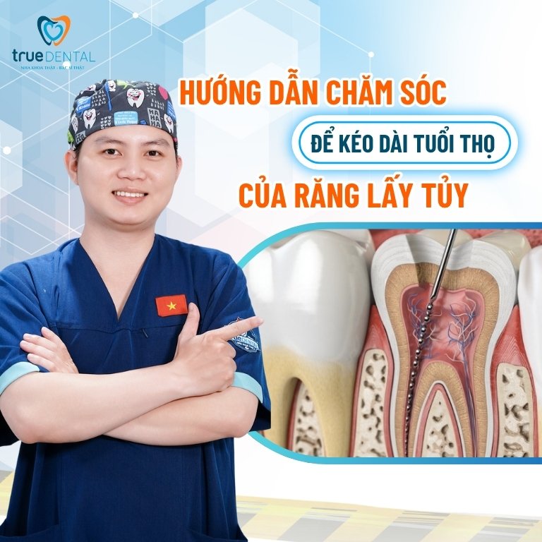 Răng lấy tủy có tồn tại được hết đời 4 Chăm sóc đúng cách để kéo dài tuổi thọ của răng lấy tủy