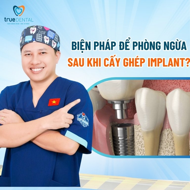 Những rủi ro có thể gặp khi cấy ghép Implant 5 Biện pháp để phòng ngừa sau khi cấy ghép Implant?