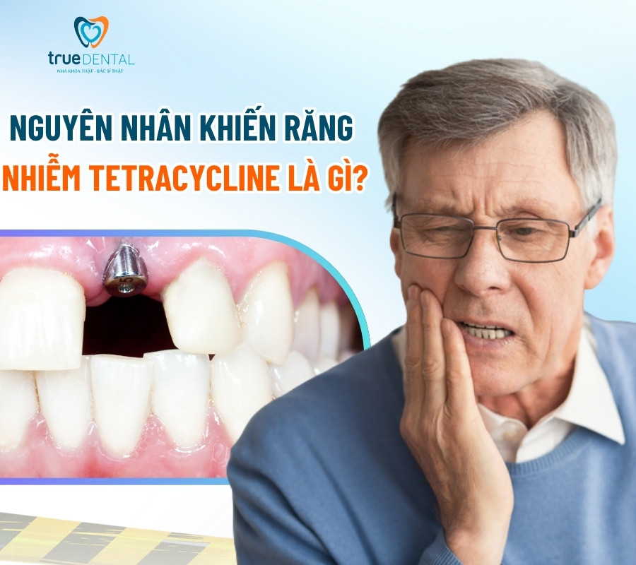 Cấy ghép Implant mất bao lâu thì hết khó chịu?