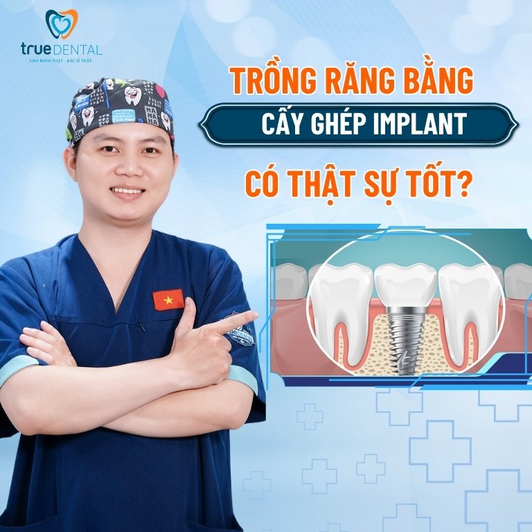 Trồng răng bằng cấy ghép implant có thật sự tốt 2 Trồng răng bằng cấy ghép Implant có thật sự tốt?