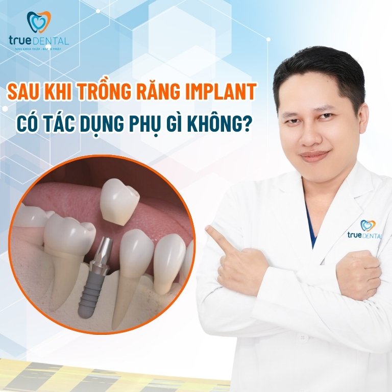Sau khi trồng răng Implant có tác dụng phụ gì không?