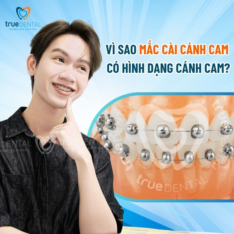Vì sao mắc cài cánh cam lại có hình dạng cánh cam? 2 Vì sao mắc cài cánh cam lại có hình dạng cánh cam?