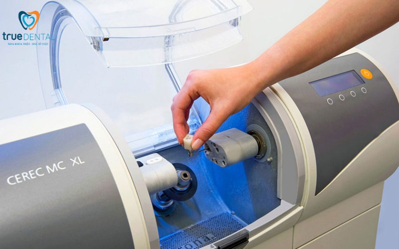 Các loại mặt dán sứ Veneer có tại True Dental