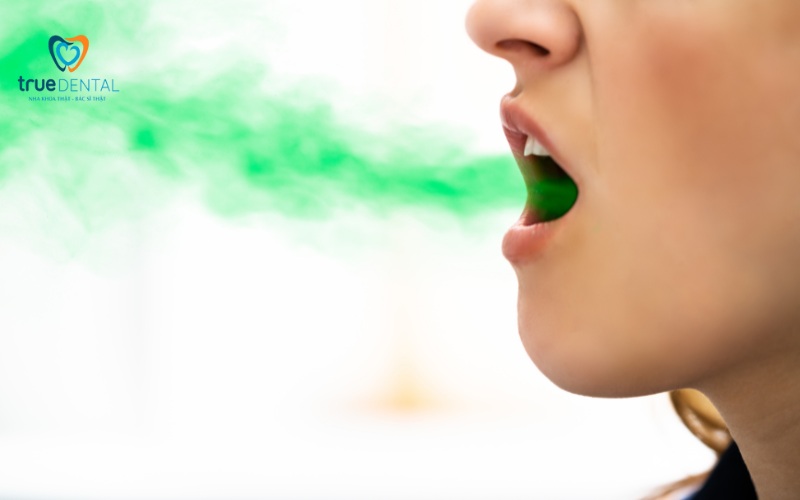 Chăm sóc răng sứ thẩm mỹ đúng cách tránh hư hại cho răng 5 Chăm sóc răng sứ thẩm mỹ đúng cách