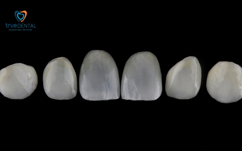 Chất liệu mặt dán sứ Veneer - Dán sứ Veneer tại True Dental 1 Chất liệu mặt dán sứ Veneer