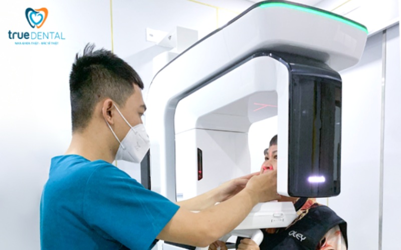 Chất liệu mặt dán sứ Veneer - Dán sứ Veneer tại True Dental 7 Chất liệu mặt dán sứ Veneer