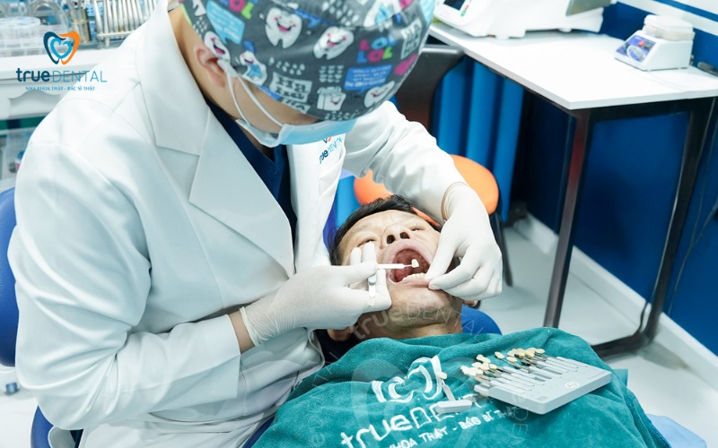 Độ dày mỏng của Veneer