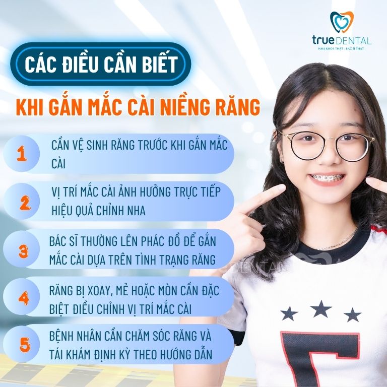 Niềng răng mắc cài được gắn vào răng như thế nào? 13 Các điều cần biết khi gắn mắc cài niềng răng
