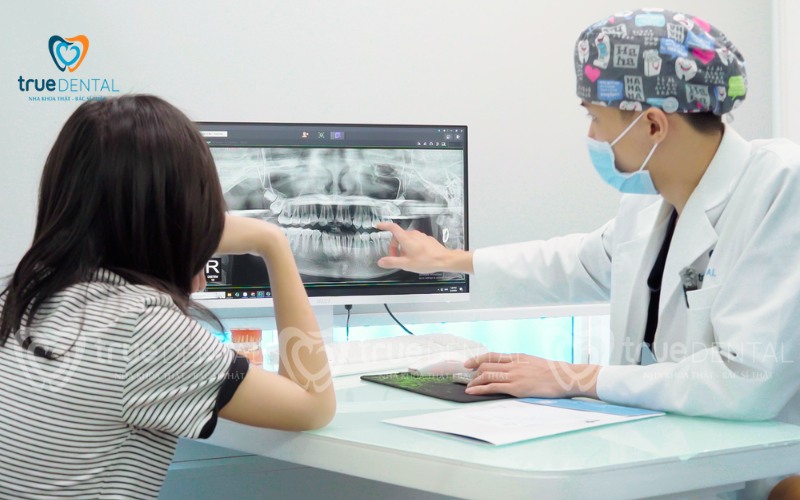 Răng khôn mọc lệch có nên nhổ không