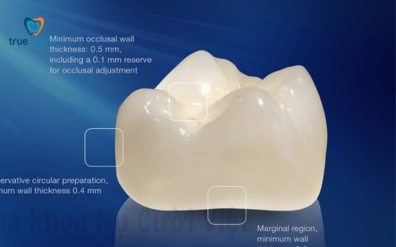 Răng sứ thẩm mỹ loại nào tốt nhất? 2 Răng sứ thẩm mỹ loại nào tốt