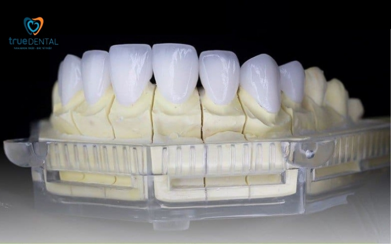 Răng sứ thẩm mỹ loại nào tốt nhất? 3 Răng sứ thẩm mỹ loại nào tốt