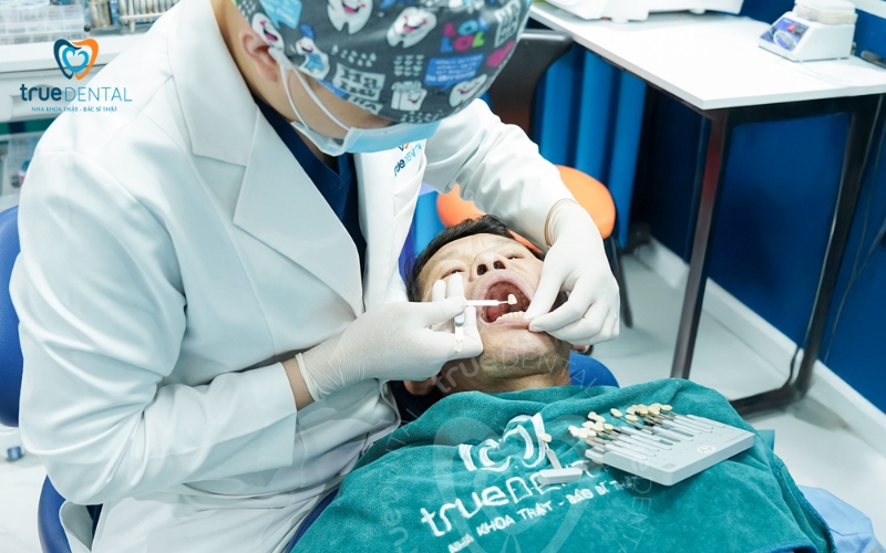 Răng sứ thẩm mỹ loại nào tốt nhất? 5 Răng sứ thẩm mỹ loại nào tốt