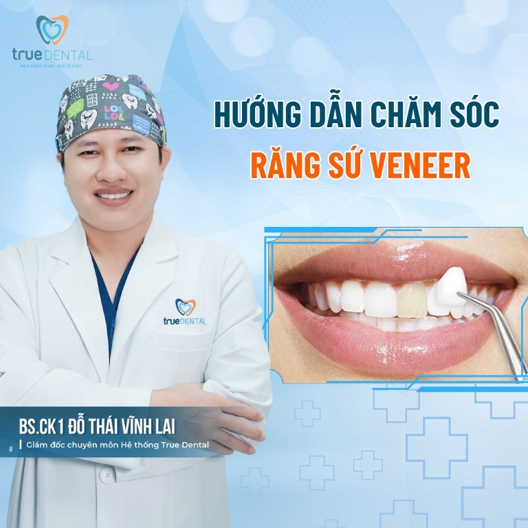 Sau khi dán sứ veneer nên làm gì? 2 Hướng dẫn chăm sóc răng sứ Veneer
