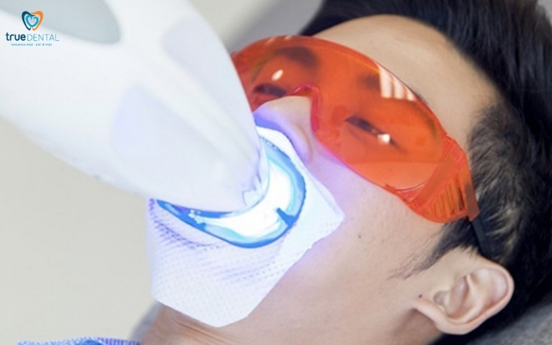 các dịch vụ nha khoa đang có tại True Dental
