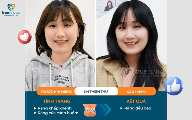 các dịch vụ nha khoa đang có tại True Dental