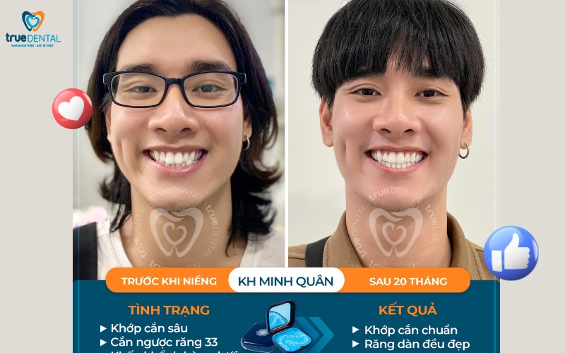 các dịch vụ nha khoa đang có tại True Dental