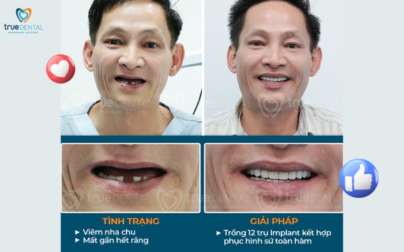 các dịch vụ nha khoa đang có tại True Dental