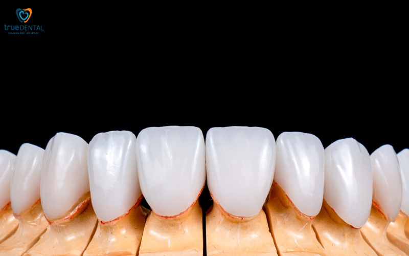 cách chọn răng sứ thích hợp cho người cao tuổi