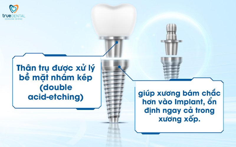 Cách chọn trụ Implant cho người cao tuổi hiệu quả 2 cách chọn trụ implant cho người cao tuổi