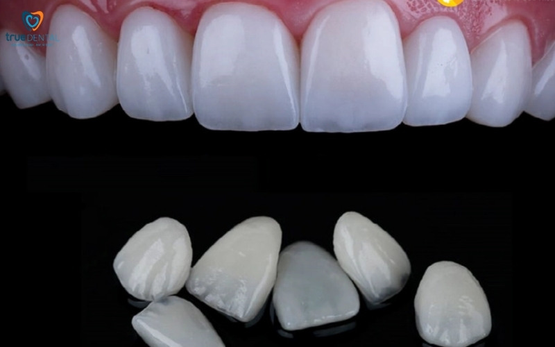 Chi phí bọc răng sứ Zirconia tại TP.HCM