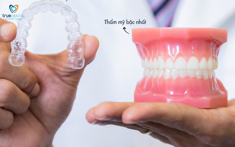 Chi phí niềng răng trong suốt tại tp.hcm