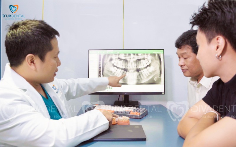 Chi phí niềng răng trong suốt tại tp.hcm