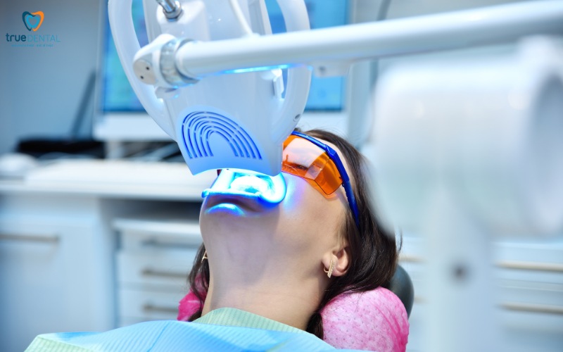 Chi phí tẩy trắng răng laser tại TP.HCM 2025 1 chi phí tẩy trắng răng laser tại TP.HCM