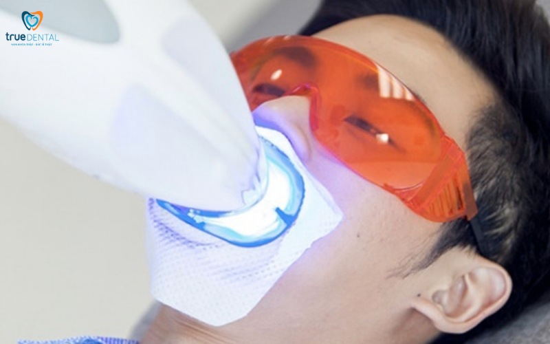 Chi phí tẩy trắng răng laser tại TP.HCM 2025 6 chi phí tẩy trắng răng laser tại TP.HCM