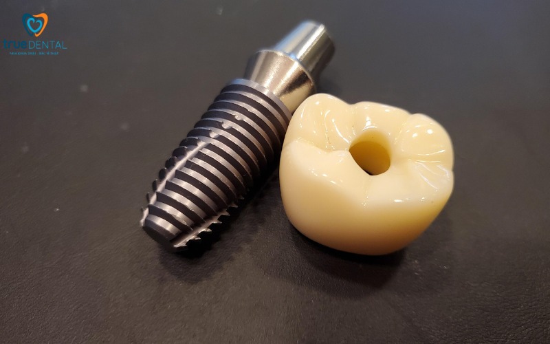 Địa chỉ cấy ghép implant giá rẻ tại TP.HCM 2 Địa chỉ cấy ghép implant giá rẻ tại TP.HCM