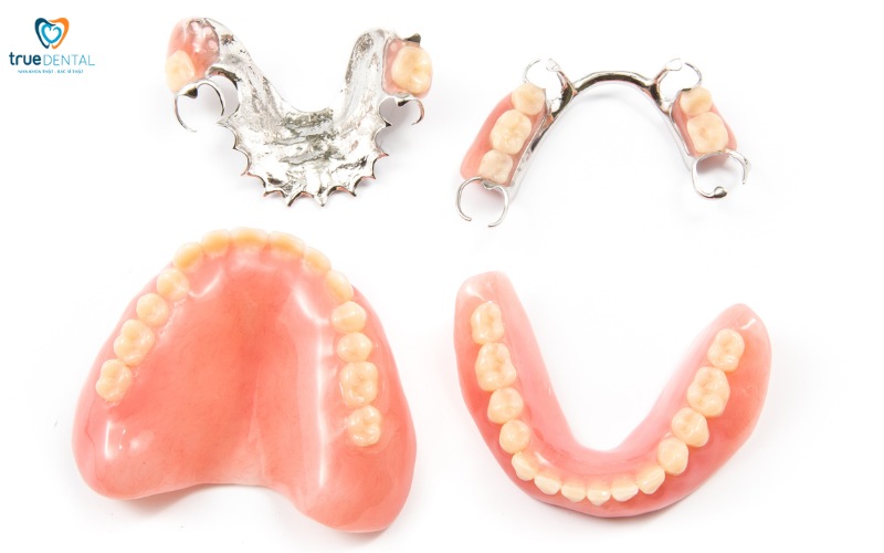 Lợi ích cấy ghép Implant so với hàm giả tháo lắp 3 Lợi ích cấy ghép Implant so với hàm giả tháo lắp