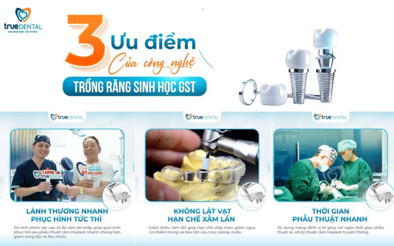 Lợi ích cấy ghép Implant so với hàm giả tháo lắp 5 Lợi ích cấy ghép Implant so với hàm giả tháo lắp