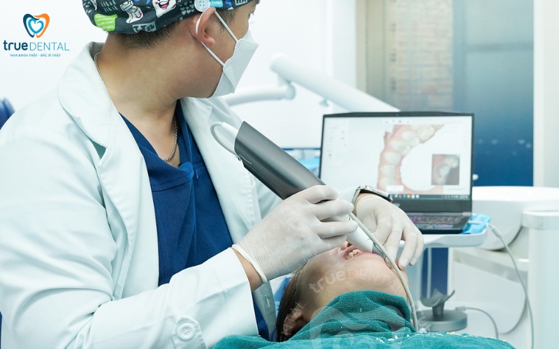 lợi ích niềng răng so với dán veneer thẩm mỹ