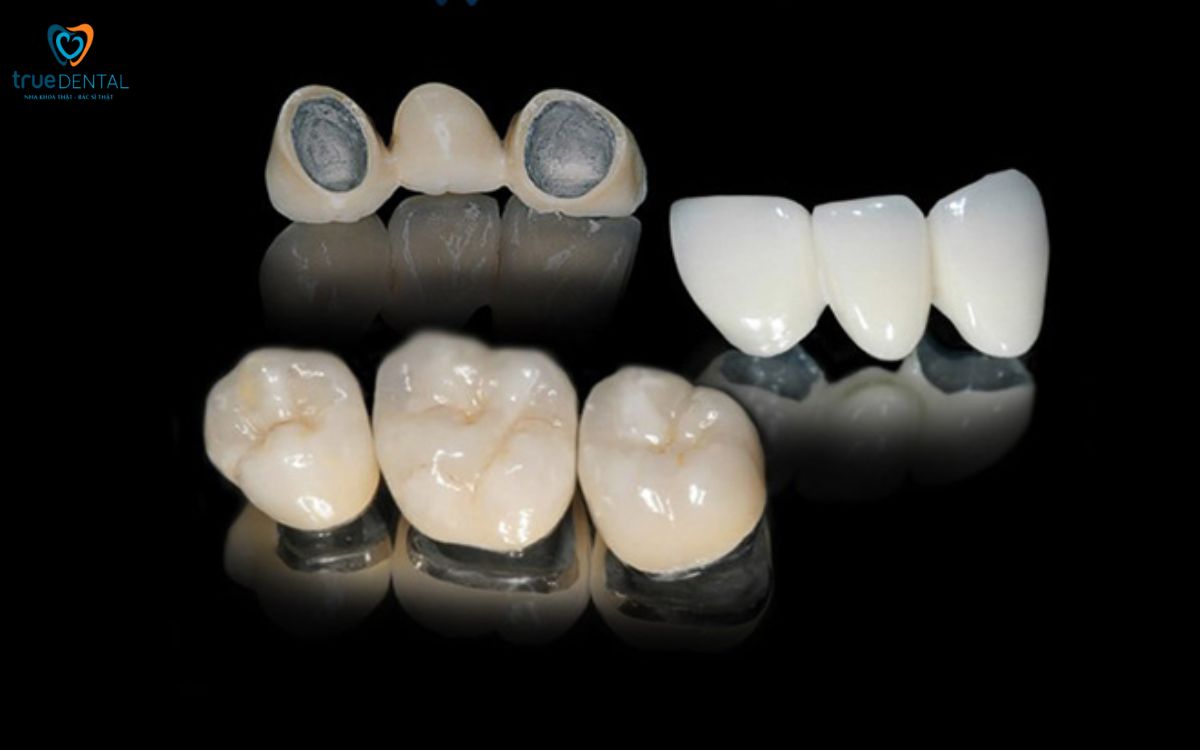 Mão răng sứ