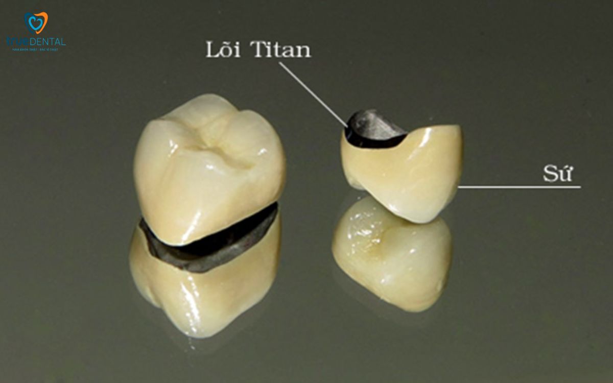 Mão răng sứ