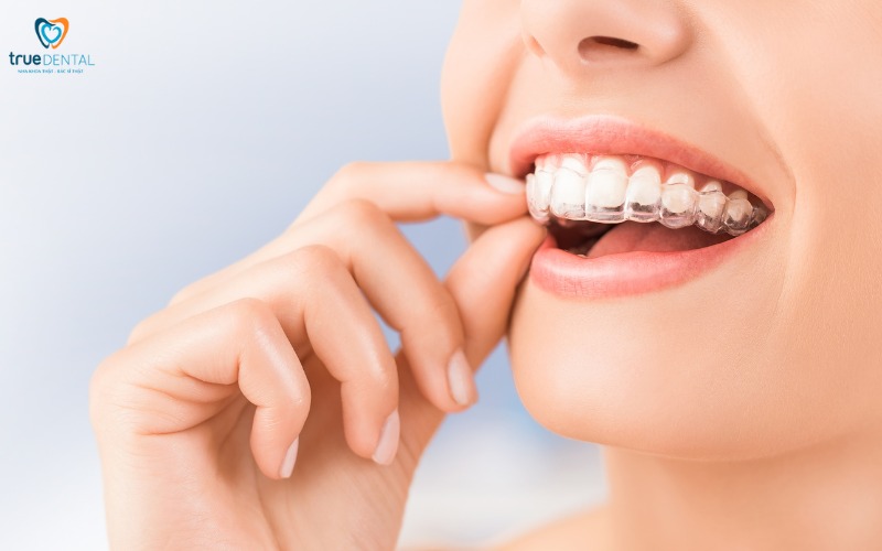 Những lý do khiến men răng bị mòn 6 men răng bị mòn
