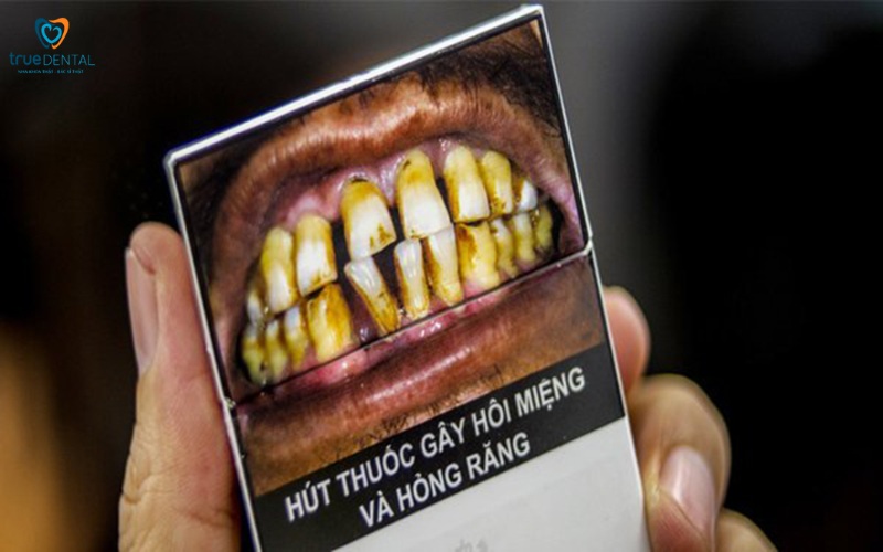 Rủi ro khi cấy ghép Implant ở người hút thuốc 1 Rủi ro khi cấy ghép Implant ở người hút thuốc
