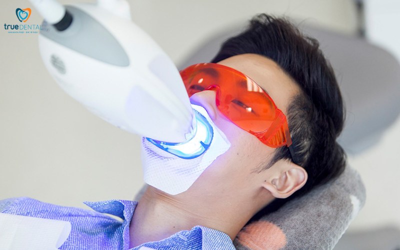 So sánh tẩy trắng răng laser và miếng dán 1 so sánh tẩy trắng răng laser và miếng dán