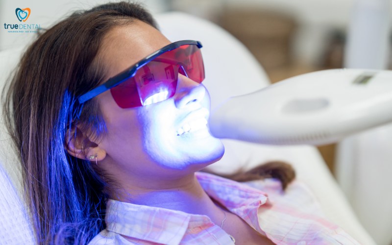 So sánh tẩy trắng răng laser và miếng dán 5 so sánh tẩy trắng răng laser và miếng dán