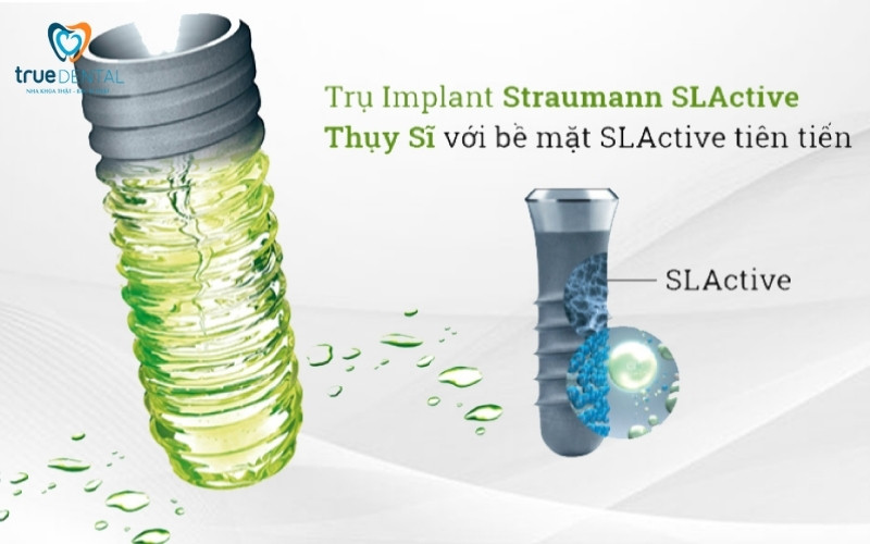 So sánh trụ implant Mỹ và Thụy Sĩ - Nên chọn loại nào? 3 so sánh trụ implant Mỹ và Thụy Sĩ