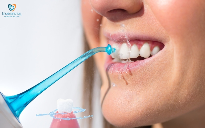 Tăm nước và chỉ nha khoa - Nên sử dụng loại nào để làm sạch răng 3 Tăm nước và chỉ nha khoa
