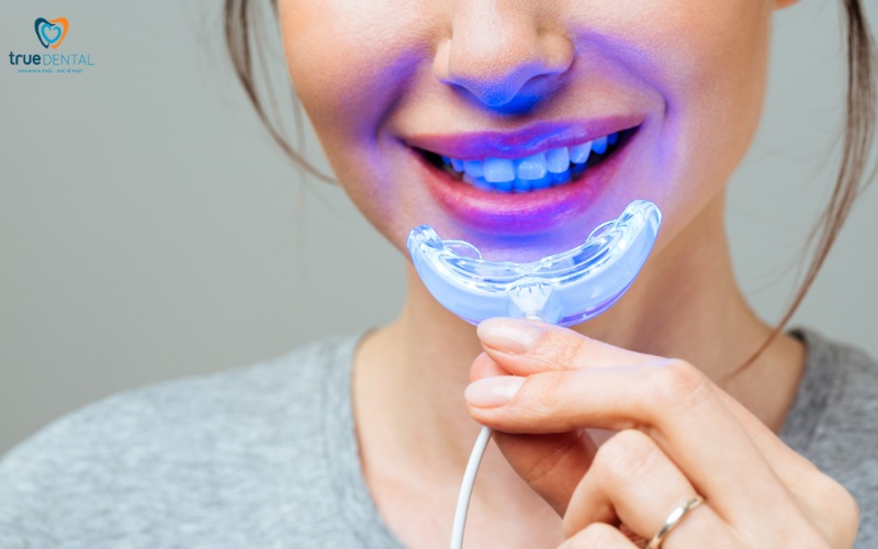 Tẩy trắng răng tại nhà an toàn và hiệu quả 1 tẩy trắng răng tại nhà an toàn