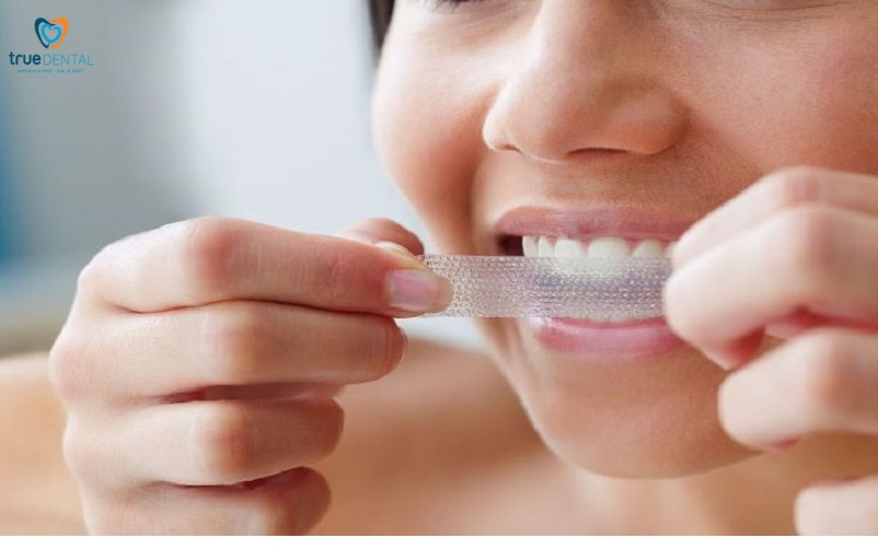 Tẩy trắng răng tại nhà an toàn và hiệu quả 4 tẩy trắng răng tại nhà an toàn
