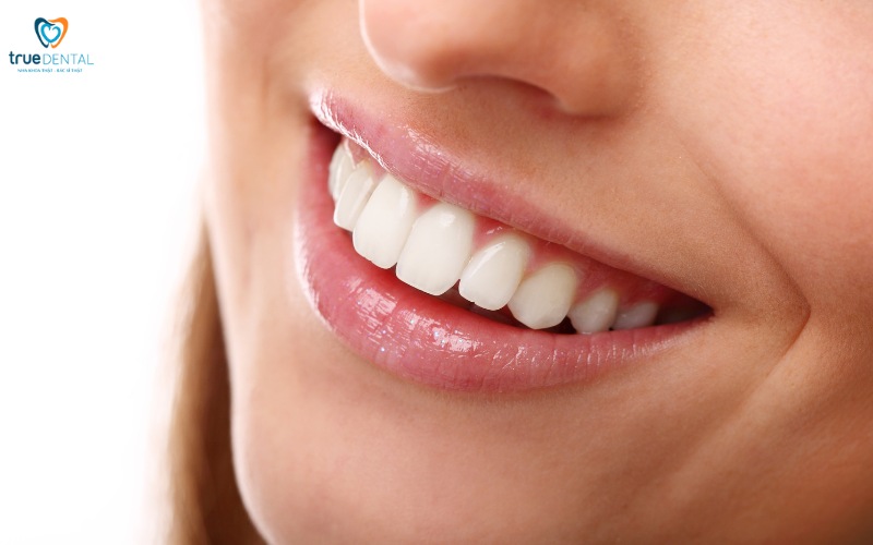 Tẩy trắng răng tại nhà an toàn và hiệu quả 6 tẩy trắng răng tại nhà an toàn