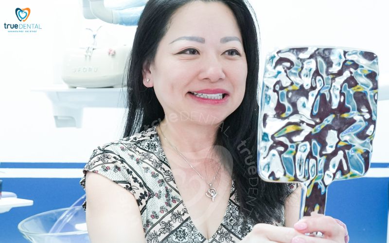 Thời gian hồi phục sau khi bọc răng sứ