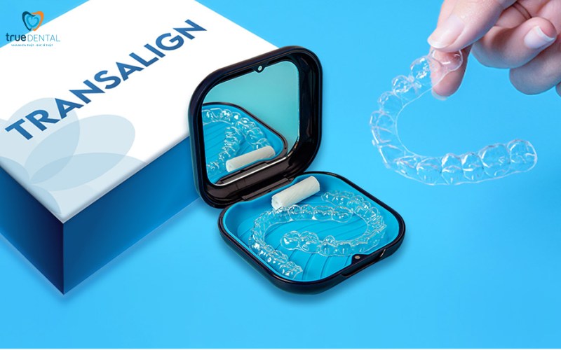 Thời gian niềng răng cho trường hợp răng hô nhẹ