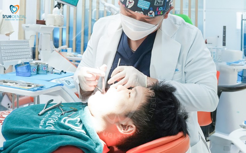 Thời gian niềng răng cho trường hợp răng hô nhẹ