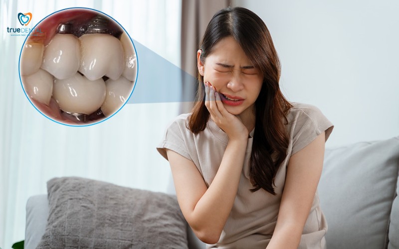 Cách chăm sóc implant sau phẫu thuật tại nhà