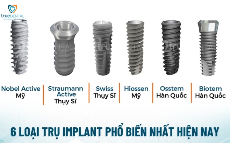 Cách nhận biết trụ implant chất lượng cao: Bí quyết lựa chọn tốt nhất 2 cách nhận biết trụ implant chất lượng cao