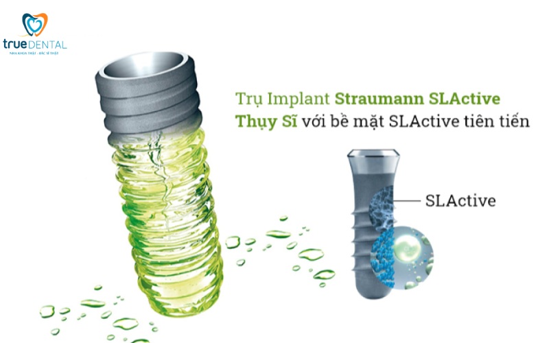 Cấy ghép implant cho người bị loãng xương: Giải pháp an toàn và hiệu quả 5 cấy ghép implant cho người bị loãng xương