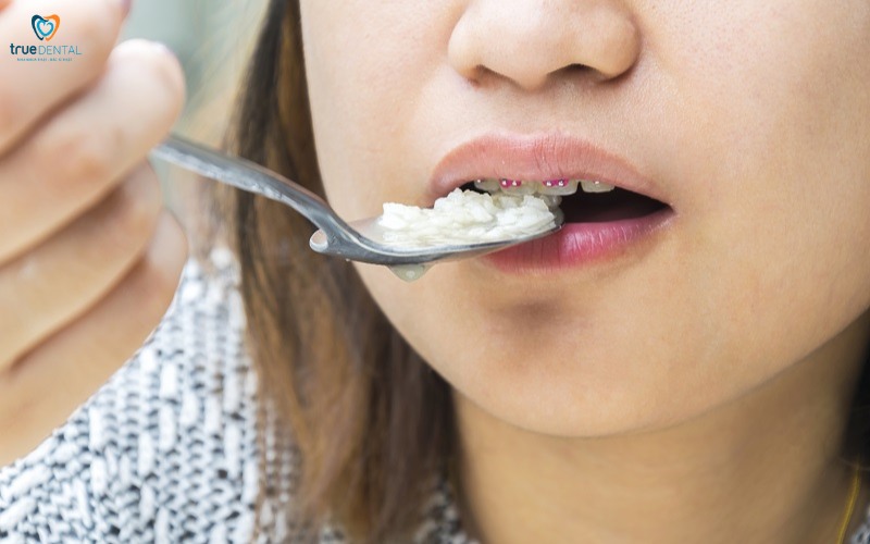 Chế độ ăn sau niềng răng 1 tháng: Hướng dẫn chi tiết cho người mới bắt đầu 1 chế độ ăn uống sau niềng răng 1 tháng